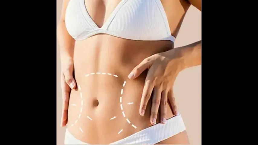 What to Consider When Looking for the Best Liposuction Surgeons in Dubai