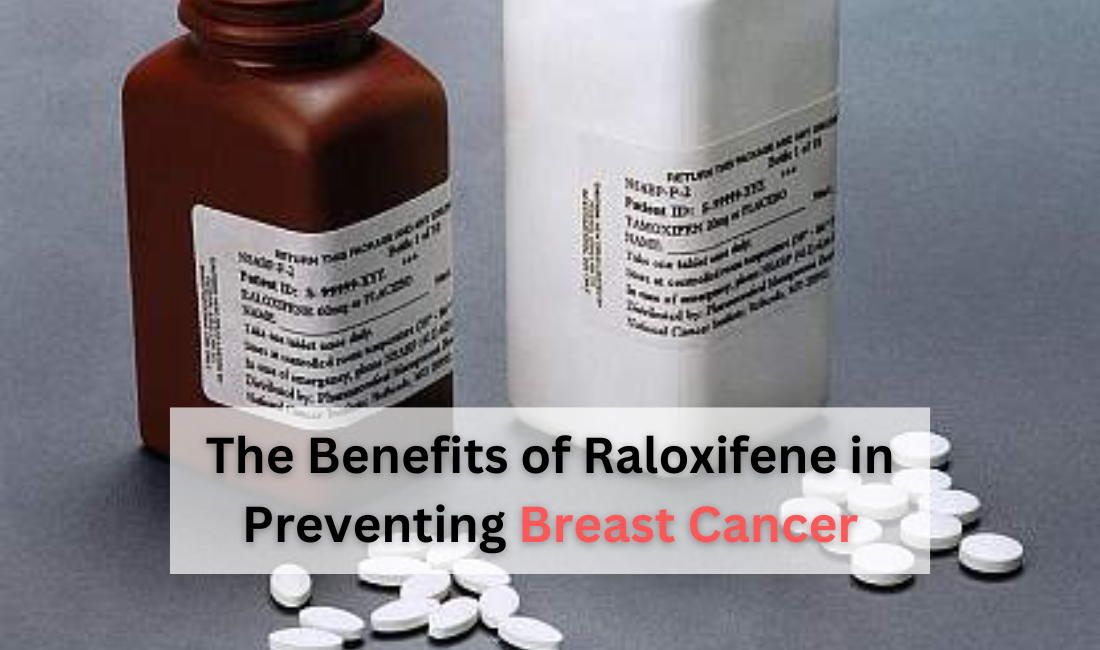 The Benefits of Raloxifene in Preventing Breast Cancer (1)