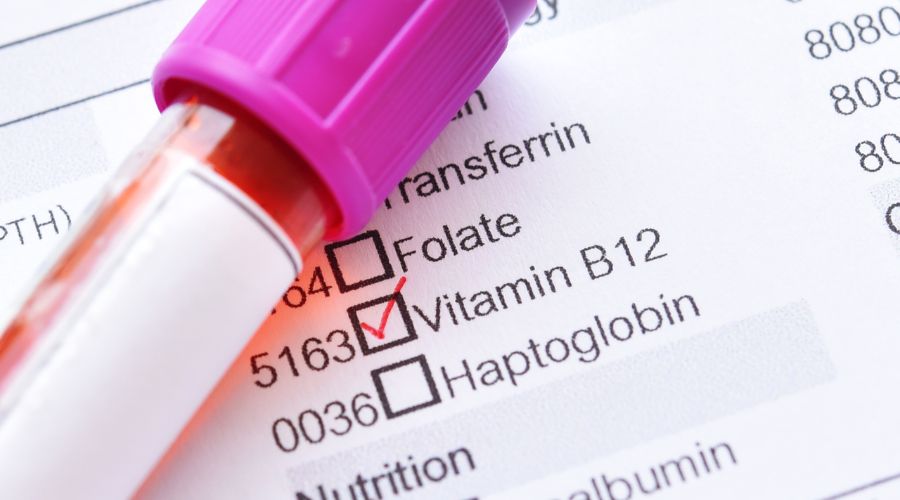 Vitamin b12 test