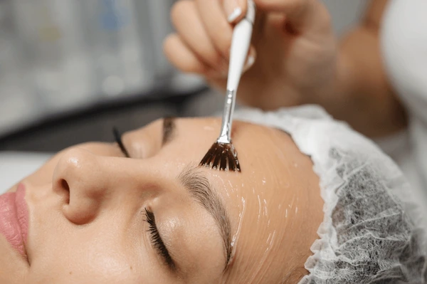 best chemical peel in Dubai