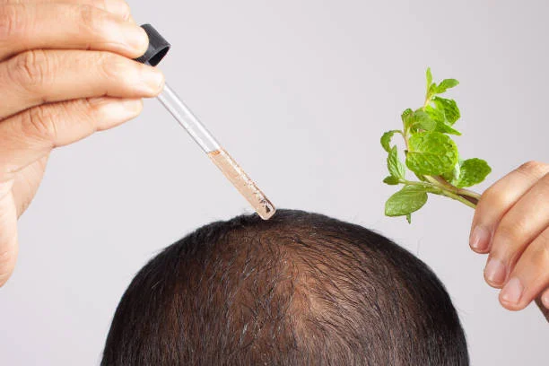 PRP Hair Treatment in Islamabad: A Natural Solution to Hair Loss