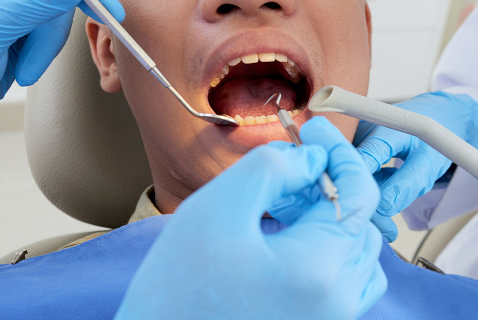 Root Canal Treatment in South Morang