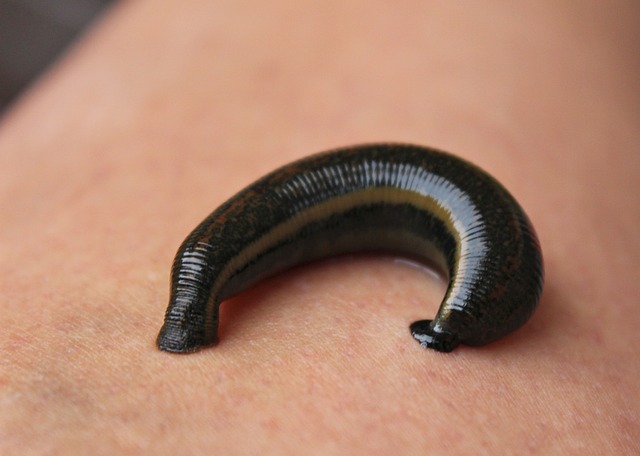 Leech Therapy