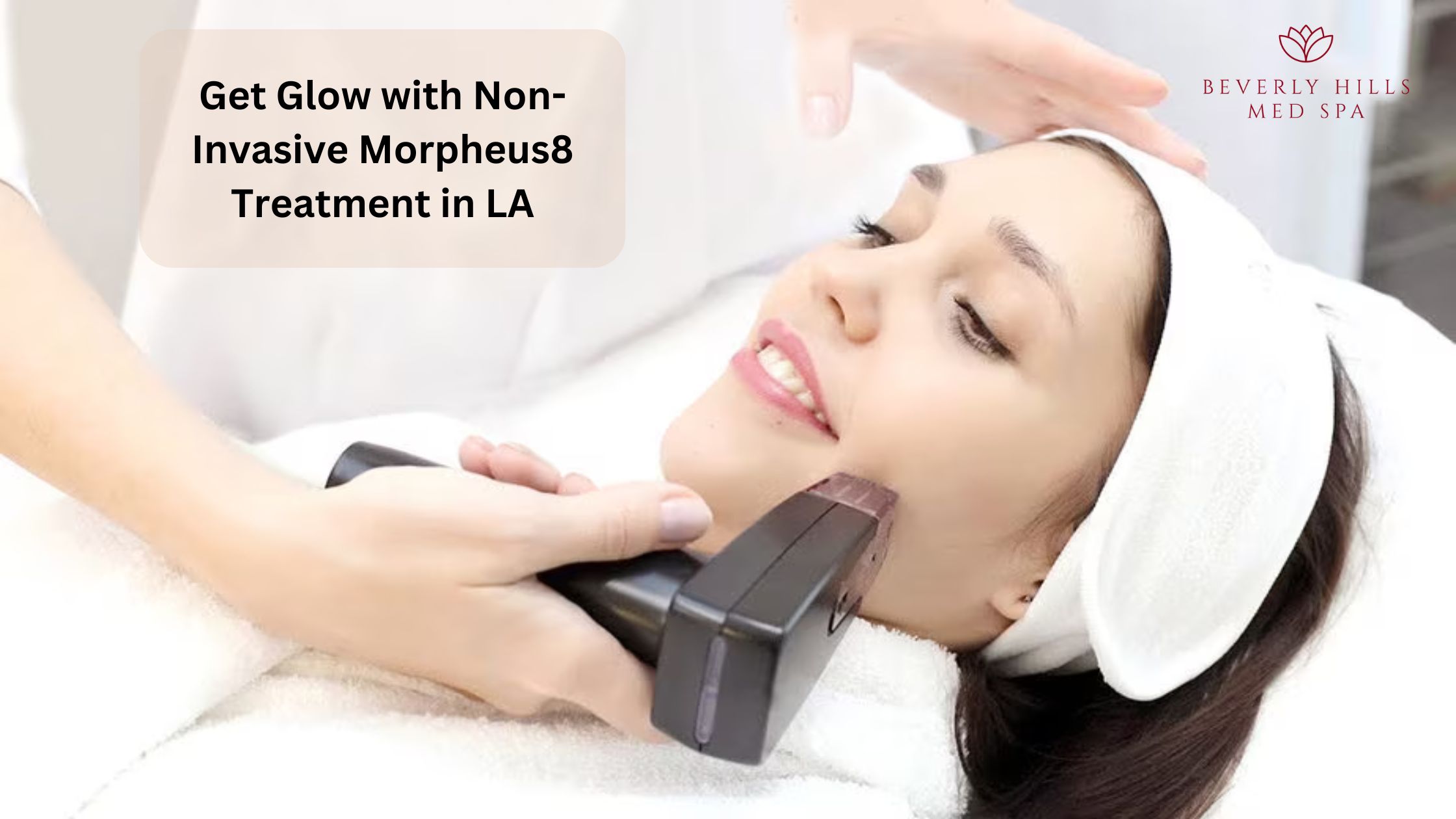 Morpheus8 treatment