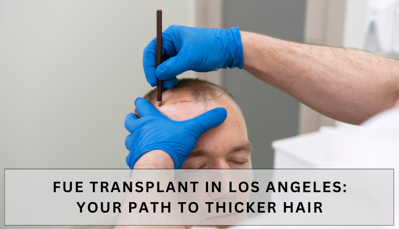 fue transplant los angeles