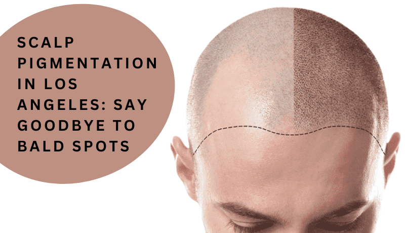 scalp pigmentation los angeles