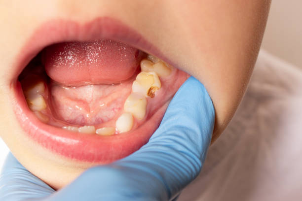 Dental