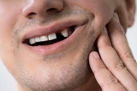 How to Respond When a Dental Emergency Strikes Unexpectedly