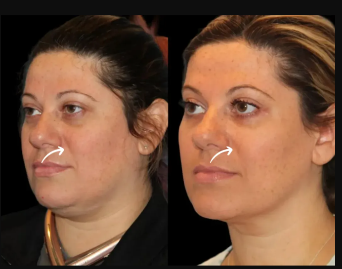 Best Plastic Surgeon in dubai