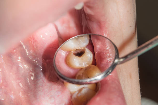 What to Expect During Your Emergency Dentist Appointment