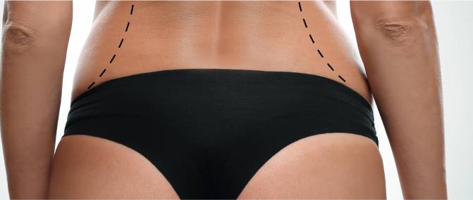 "Transform Your Silhouette with Body Contouring in Dubai"