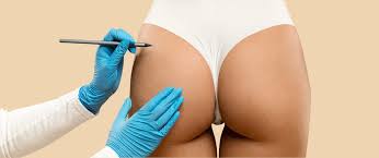 How the Best Butt Fat Transfer Surgeons in Dubai Ensure Patient Safety Throughout the Process