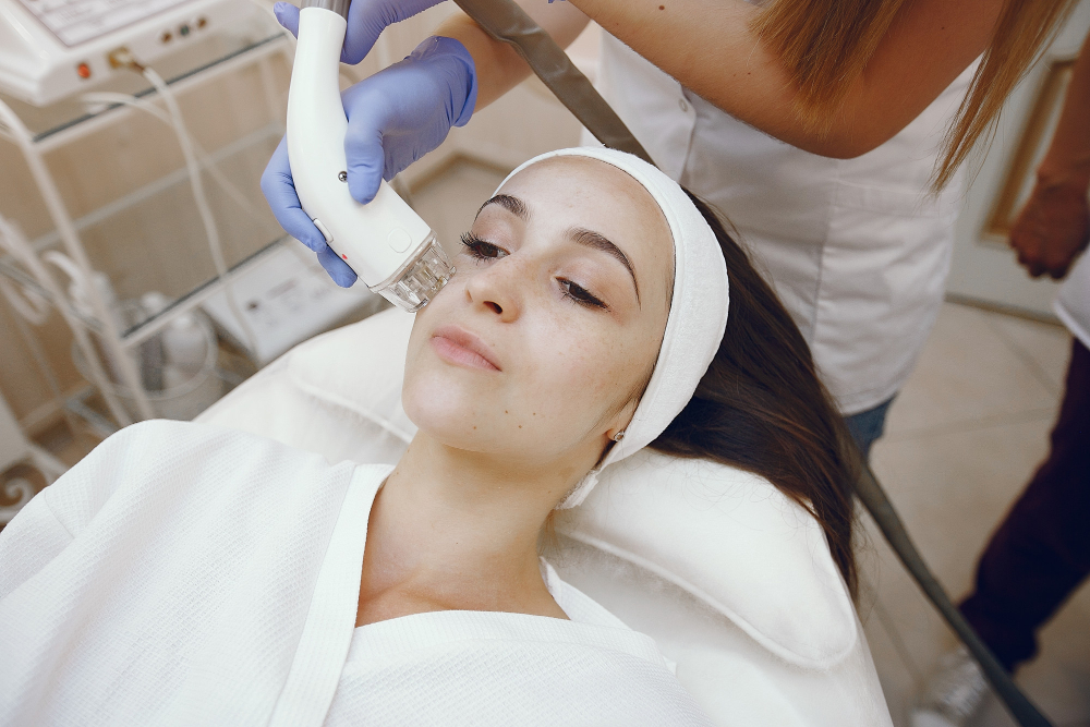 CO2 laser for acne scarring