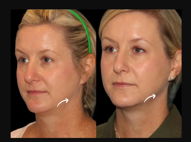Best Aesthetic Clinics in dubai