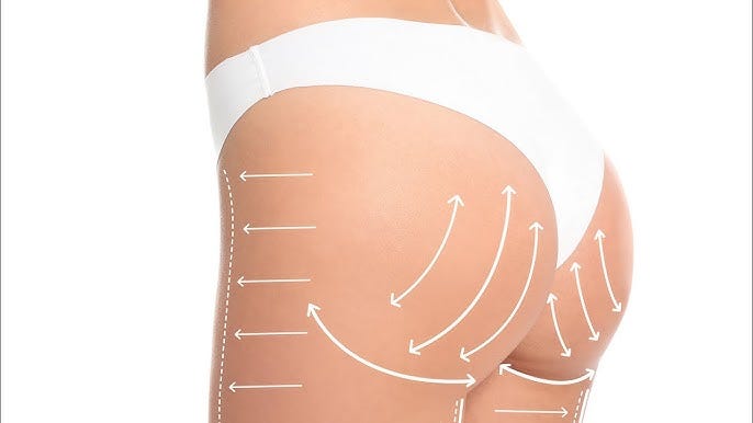 butt fat transfer dubai