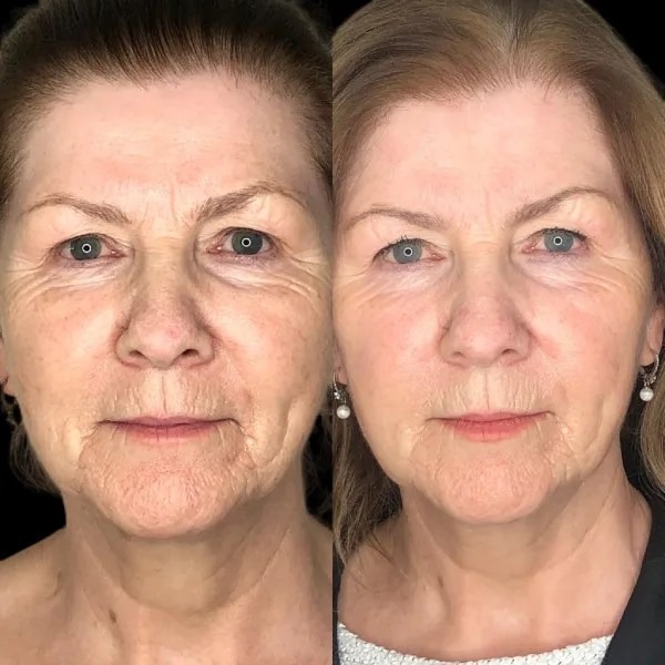 Best Plastic Surgeons in dubai