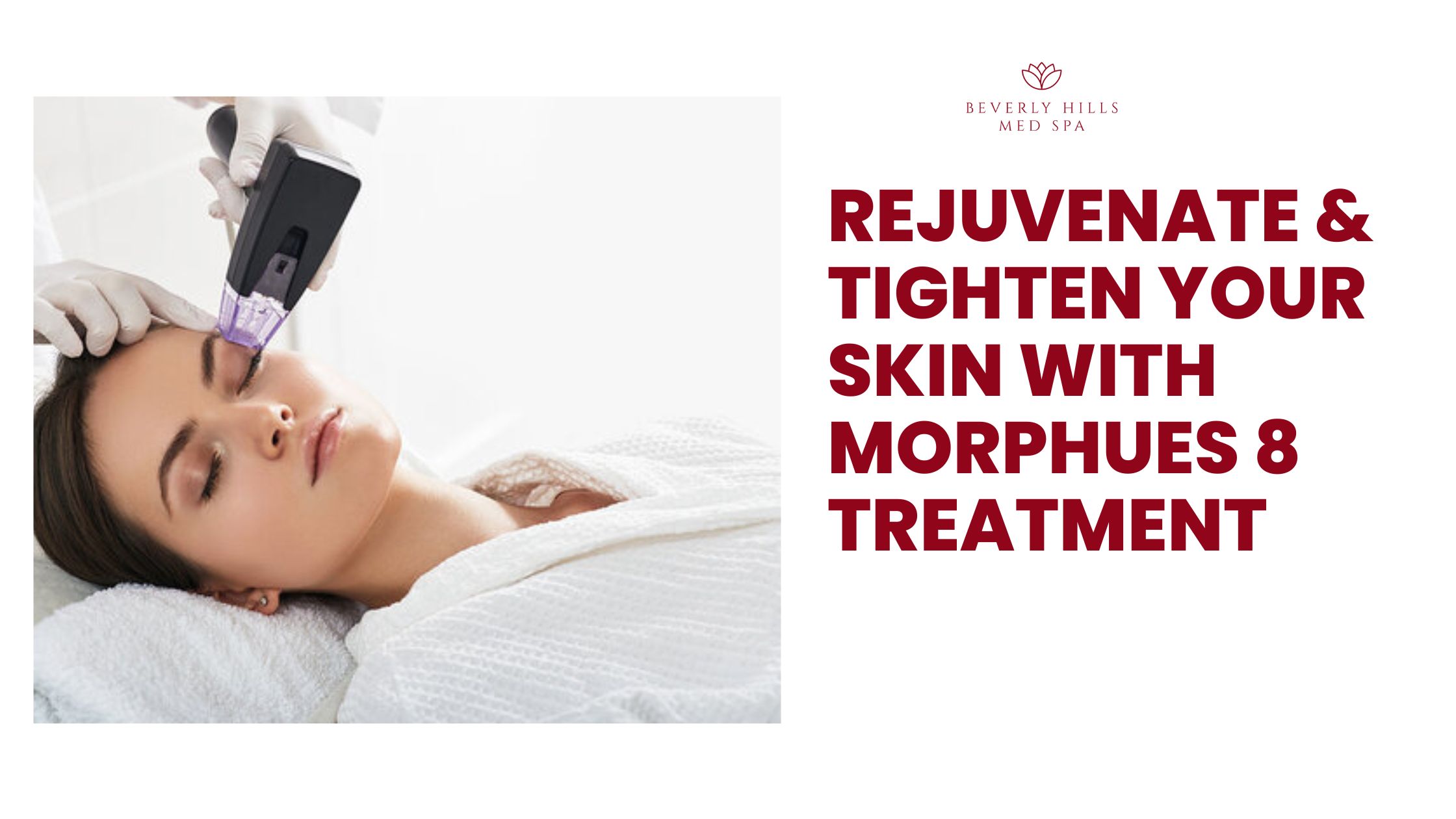 morpheus8 beverly hills
