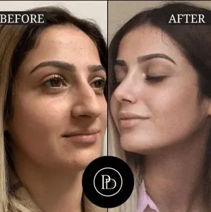 Why This is the Best Plastic Surgeon in Dubai