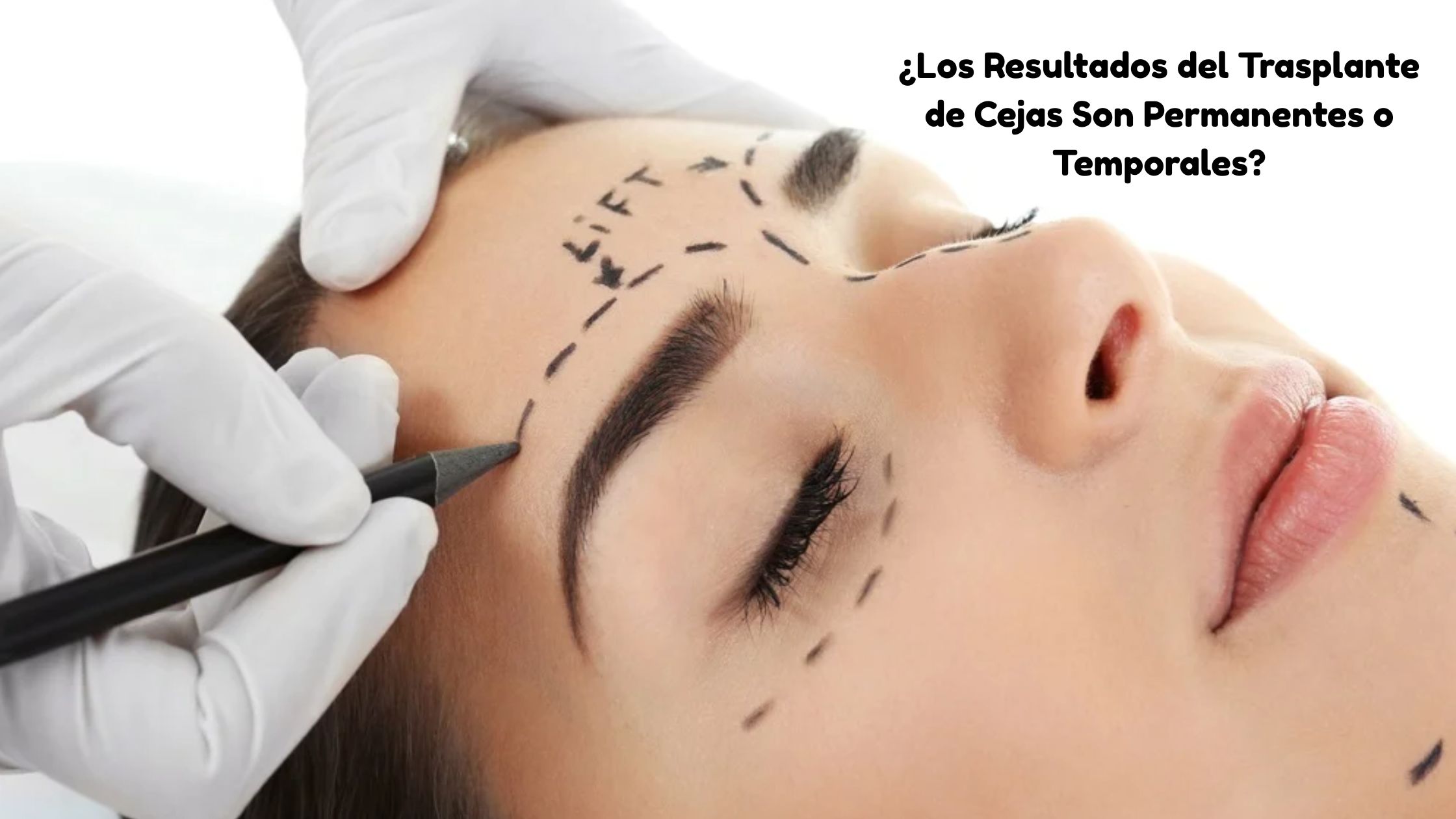 trasplante de cejas