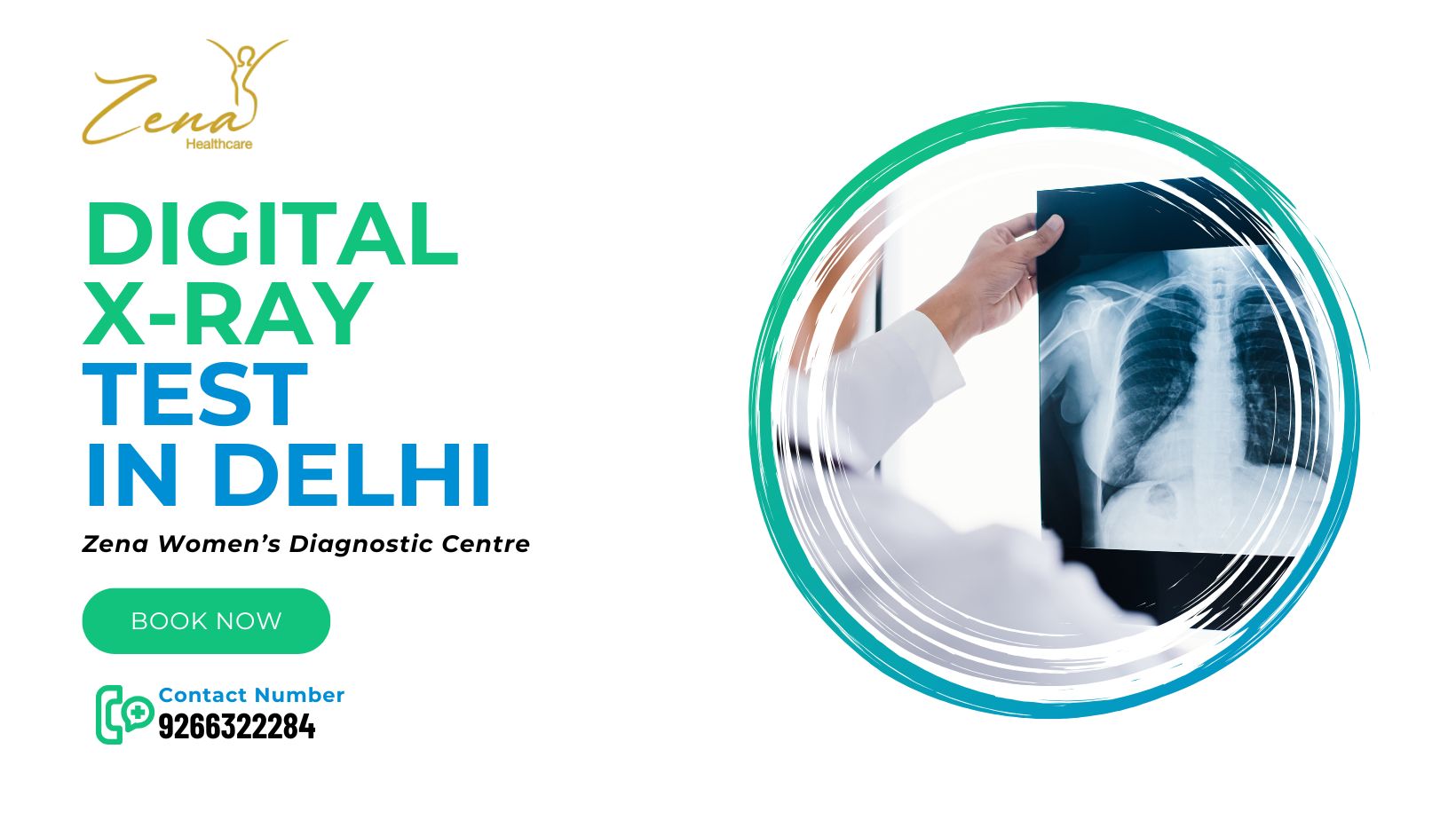 Digital X-Ray