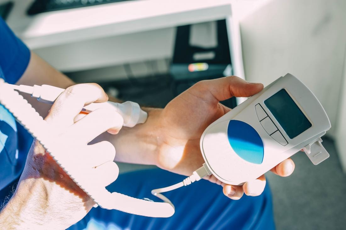 Doppler Ultrasound