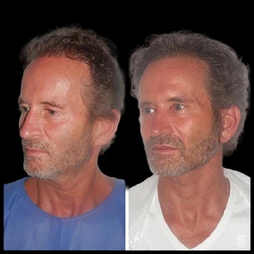 Best Plastic Surgeon in dubai