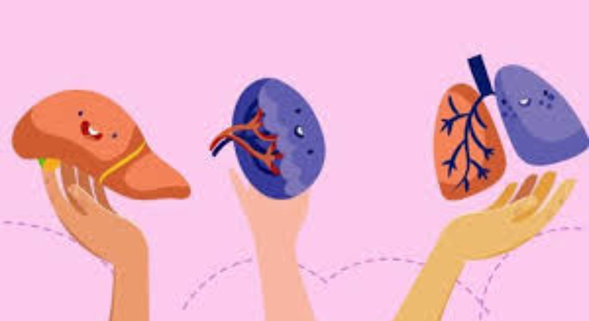 liver transplant image