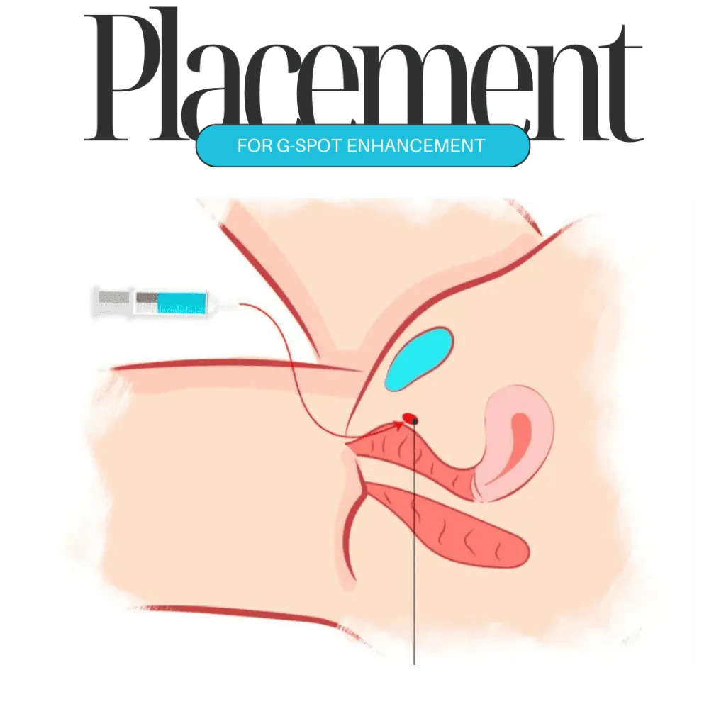 Best Doctor For G-Spot Enhancement in Dubai