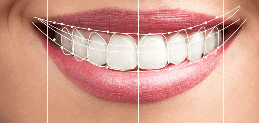 "Perfect Your Look with Advanced Digital Smile Design in Dubai"