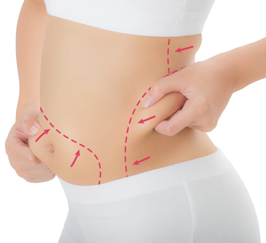Liposuction in Dubai