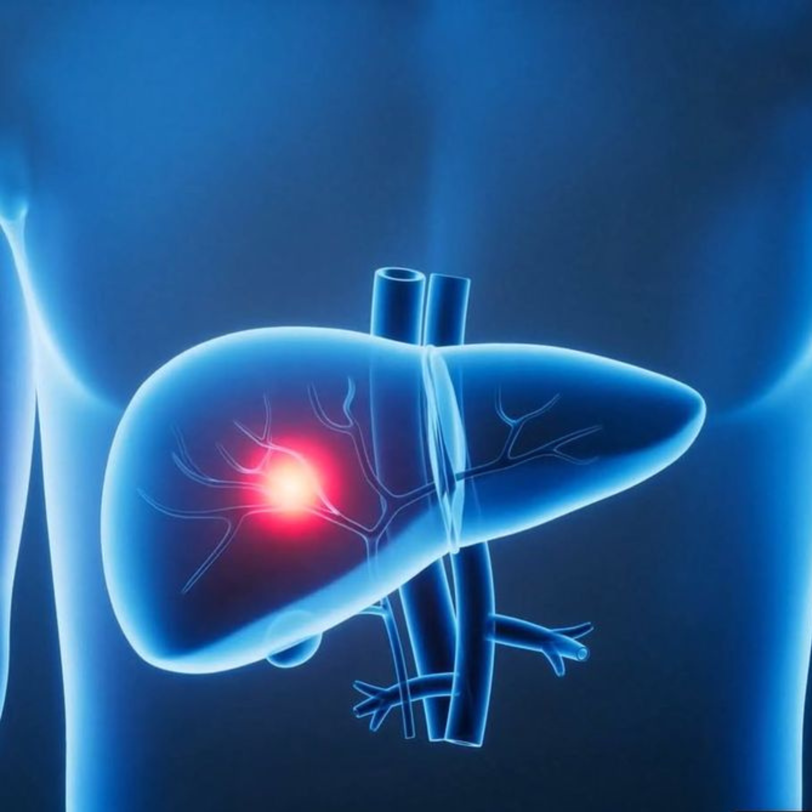 best gastro doctor in Delhi