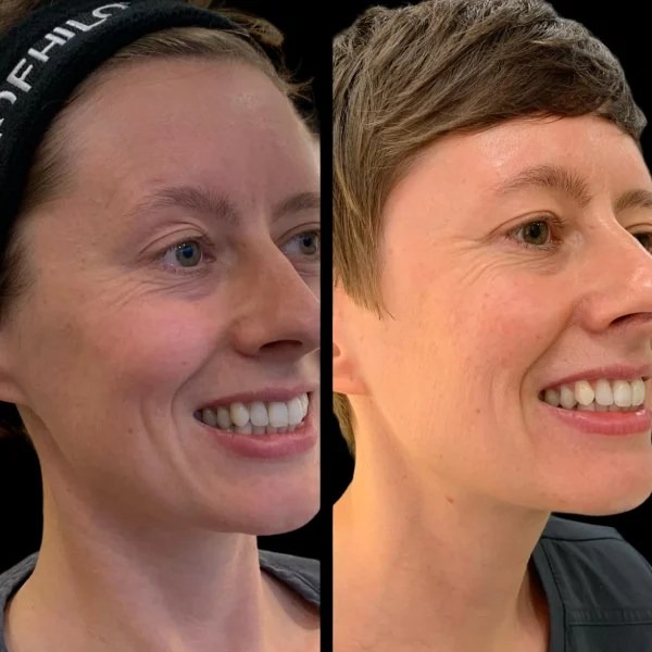 Best Plastic Surgeon in dubai