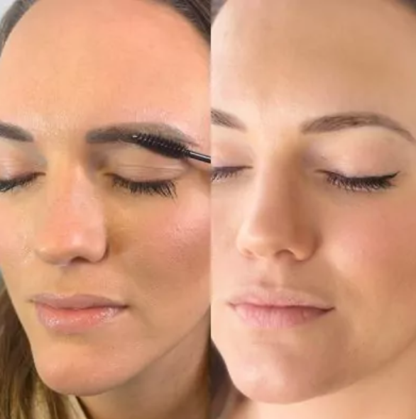 saline solution tattoo removal