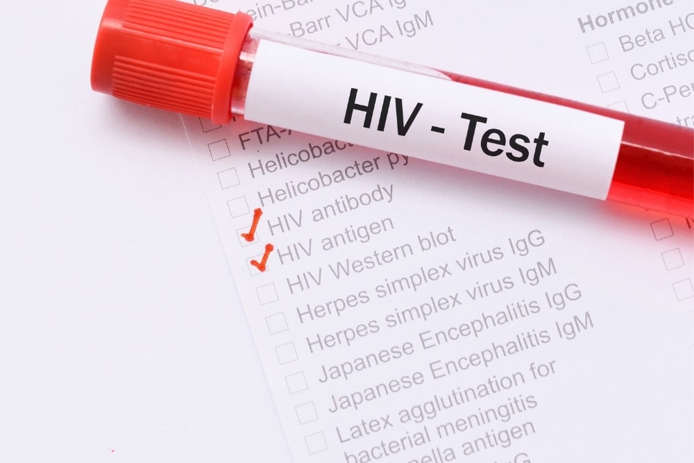 Why Getting an HIV Test NYC Is Essential for Your Sexual Health
