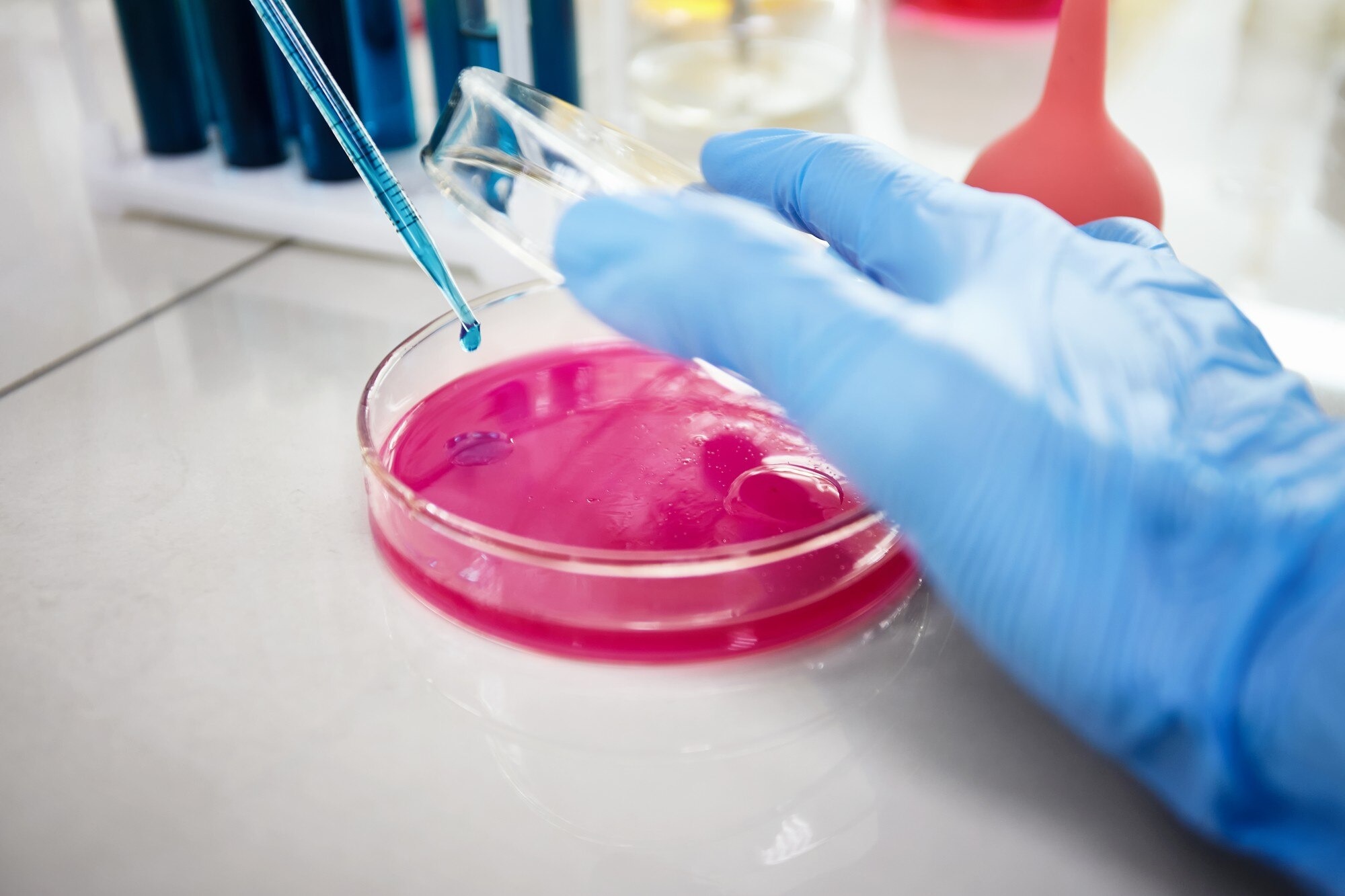 Protein A Chromatography Resin