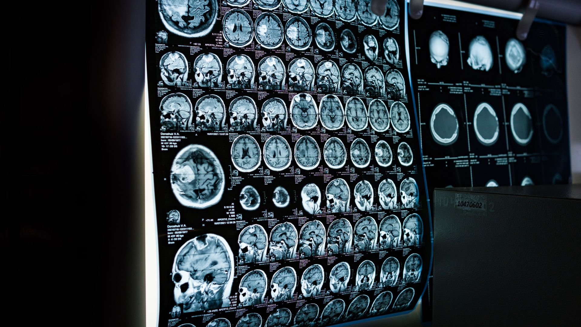 Radiology Information System Market