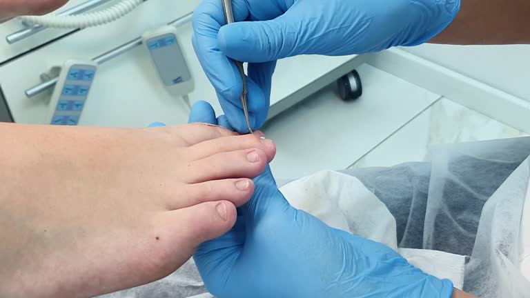 ingrown toenail treatment near me